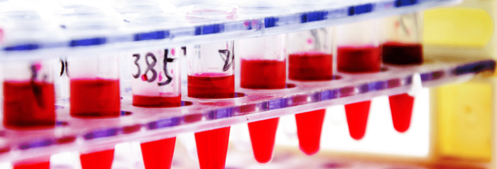 Test tubes, containing blood, on a test tube rack awaiting laboratory analysis.