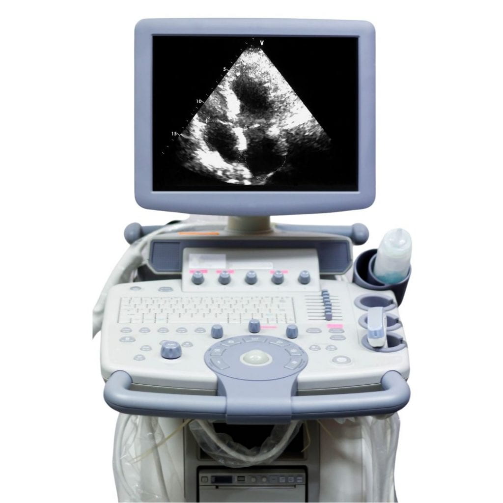 Ultrasound displaying black and white machine.